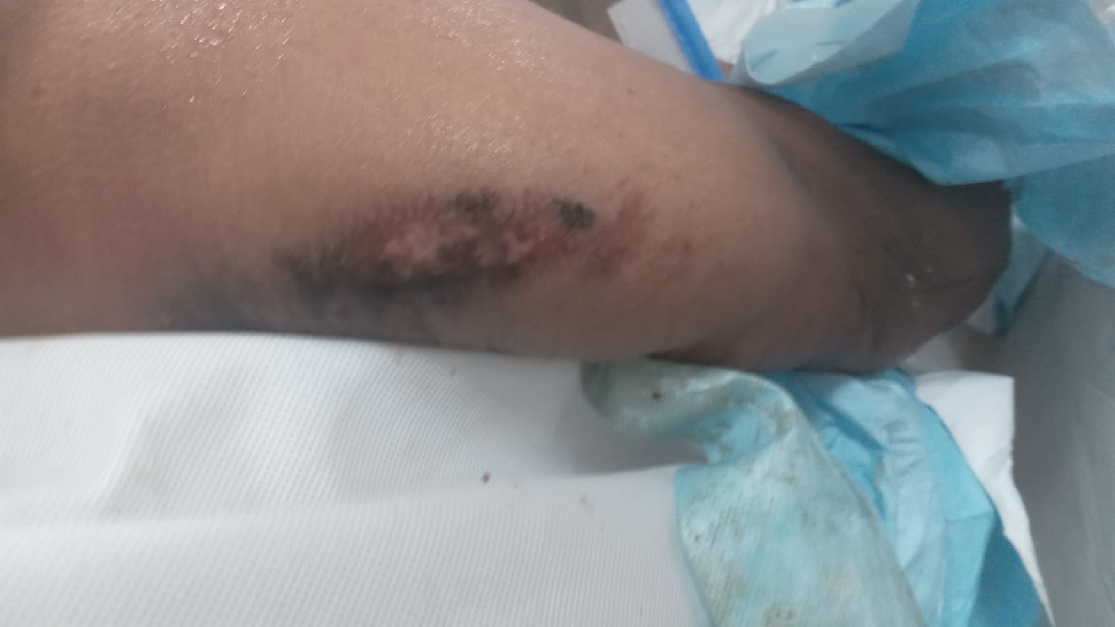 Scar Image
